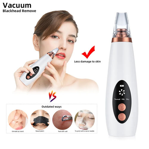 ClearGlow Pro™ Blackhead Remover ✨💨