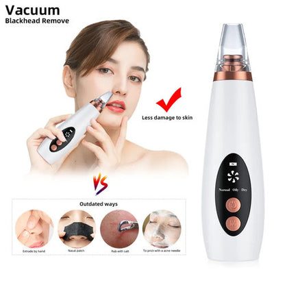 ClearGlow Pro™ Blackhead Remover ✨💨