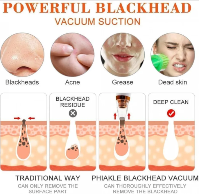 ClearGlow Pro™ Blackhead Remover ✨💨